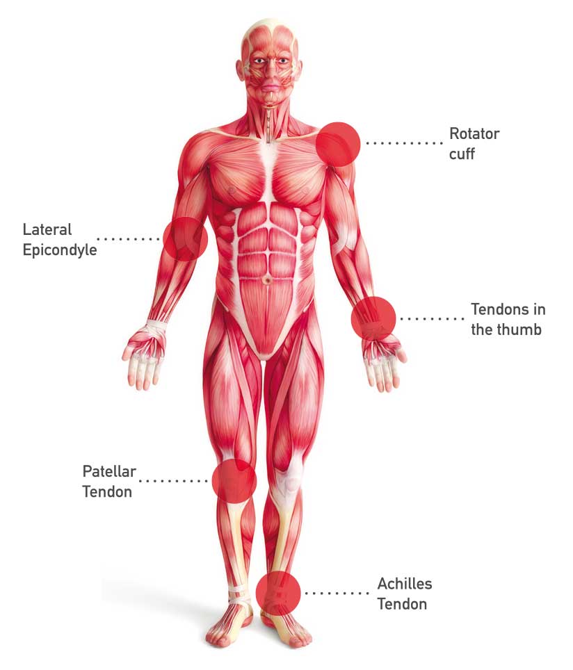 Gramm Tendoactive , Συμπλήρωμα Διατροφής για την αποκατάσταση Τενόντων και Συνδέσμων 60 Caps